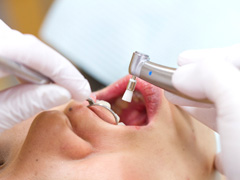 主な予防歯科メニュー